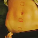 స్టికర్